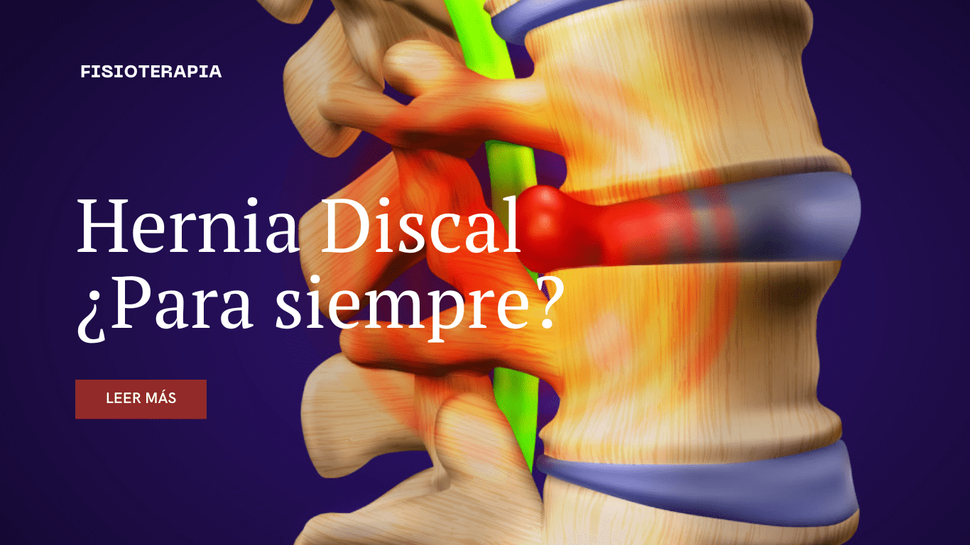 Lee más sobre el artículo Hernia Discal: ¿Es para siempre?