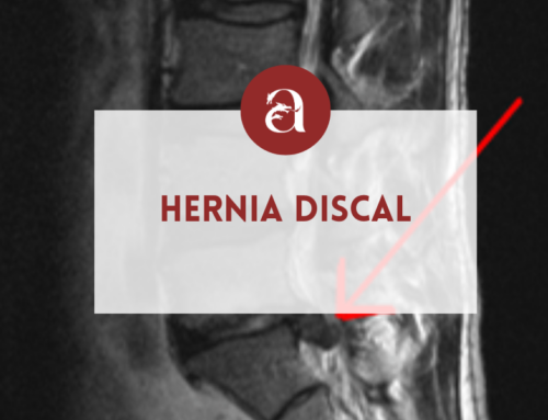 Hernia discal